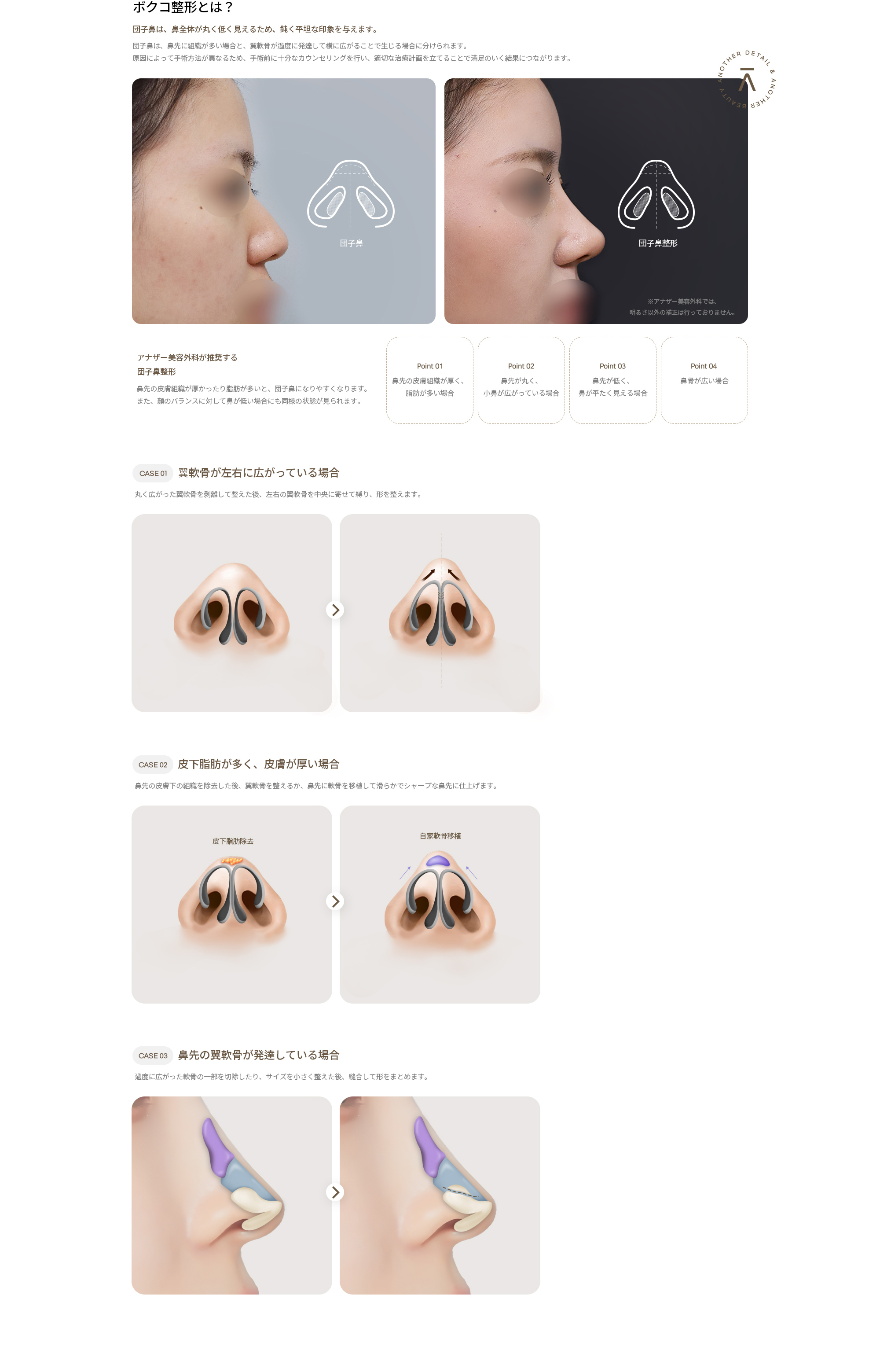 アナザー整形外科 ボクコ