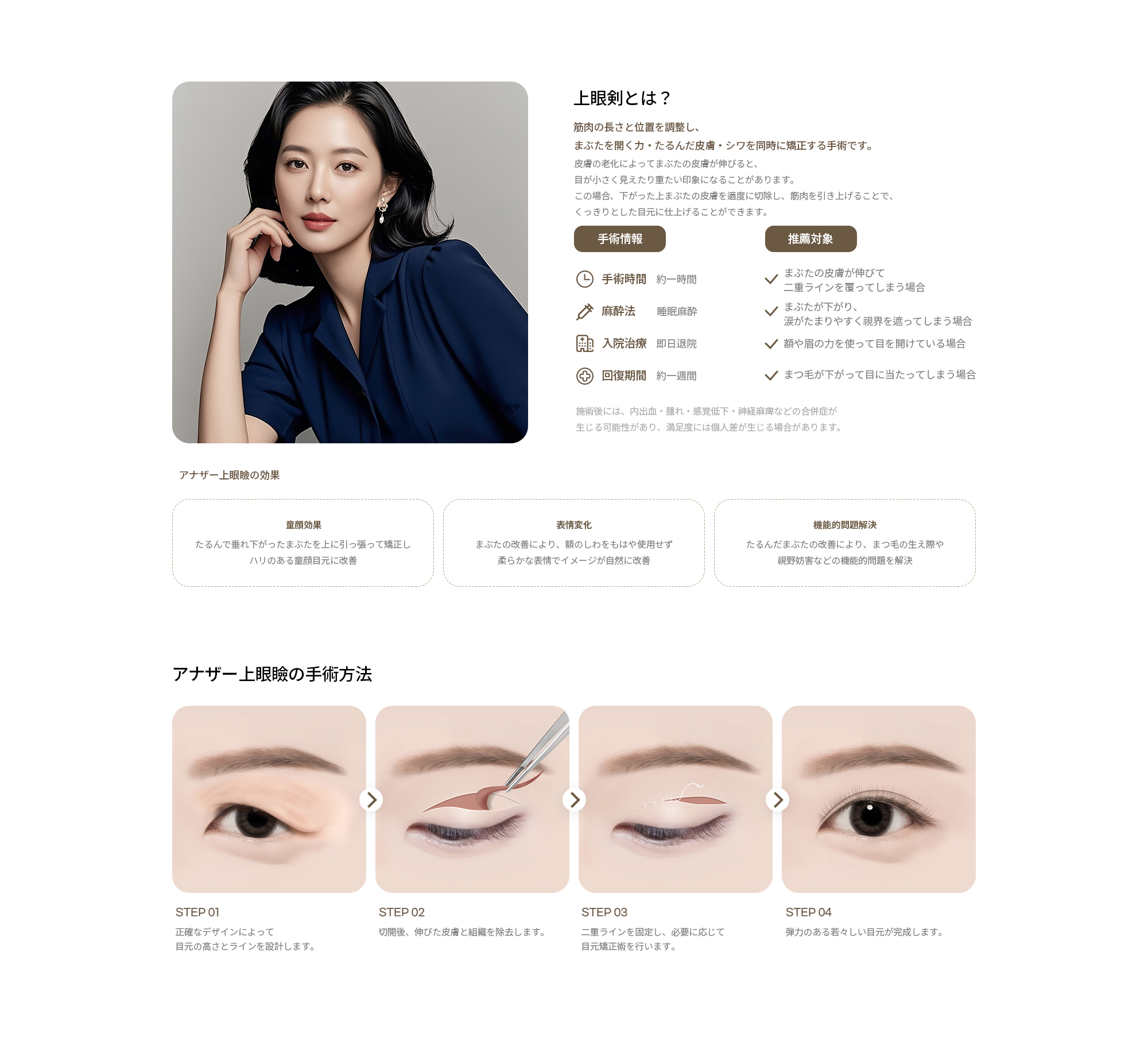 アナザー整形外科 上眼瞼